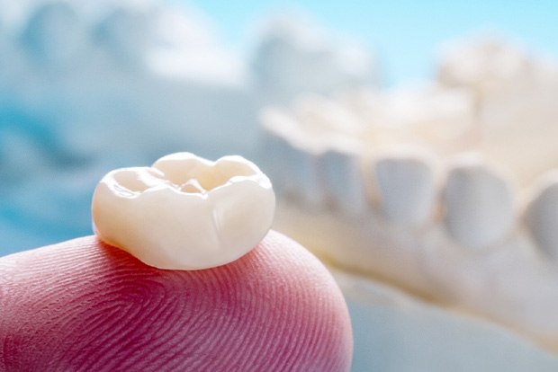 Dental crown on fingertip with model jaw in background