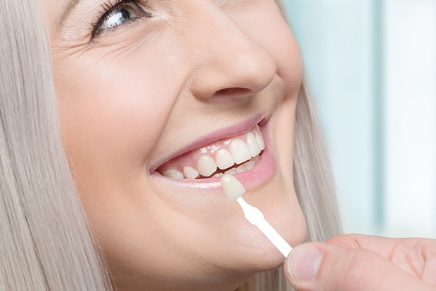 Woman's smile compared with porcelain veneers shade chart