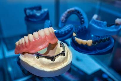 Implant denture in Bedford being crafted in a dental lab