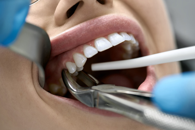 Patient in Bedford getting a tooth extraction