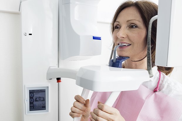 Woman receiving 3 D C T cone beam x-ray scans