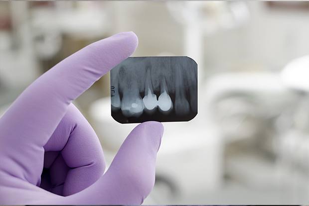 Dentist holding dental x-rays of section of teeth