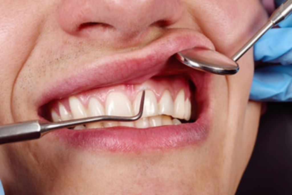 Person having their gums inspected by their dentist.