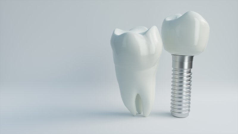 Close-up of dental implant 